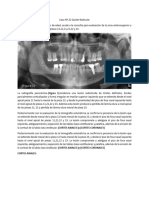 Caso #22 Quiste Radicular