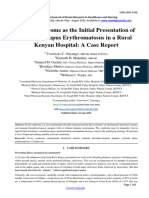 Evans Syndrome as the Initial Presentation of  Systemic Lupus Erythromatosus in a Rural  Kenyan Hospital: A Case Report