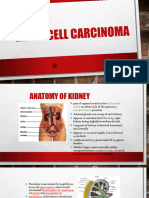 dr. Budi_CARCNOMA RENAL