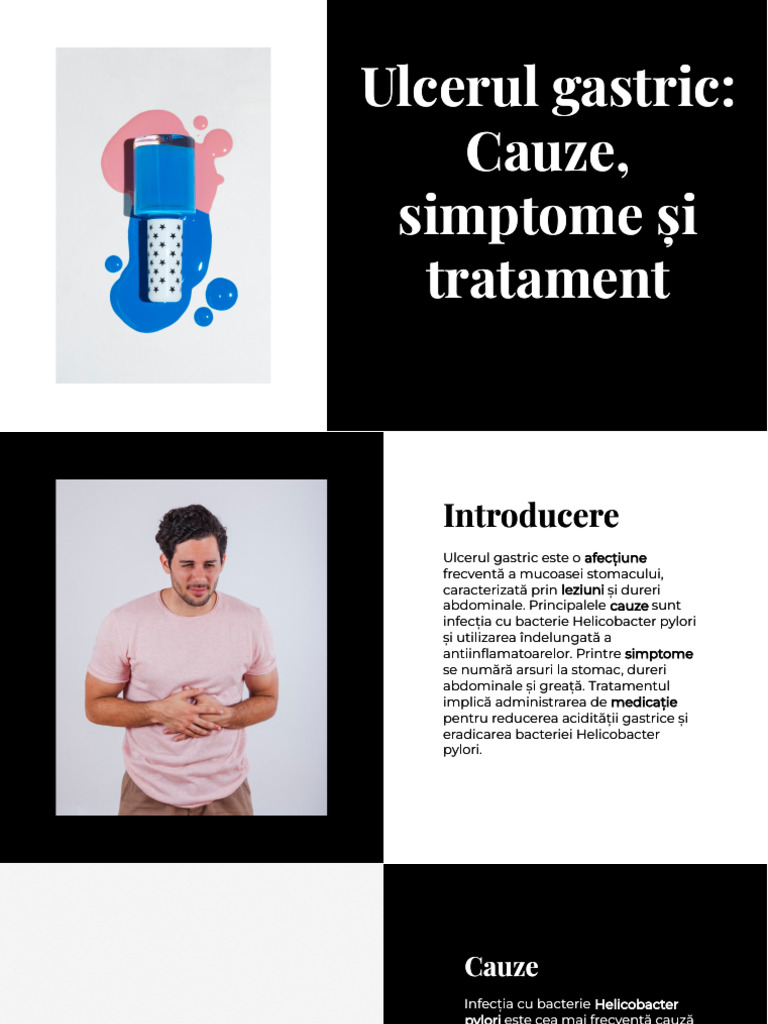 Wepik Ulcerul Gastric Cauze Simptome Si Tratament 202405100731579MMg | PDF