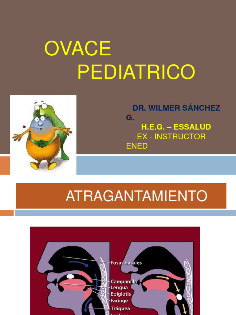 Guía de OVACE en Niños y Lactantes | PDF | Reanimación cardiopulmonar