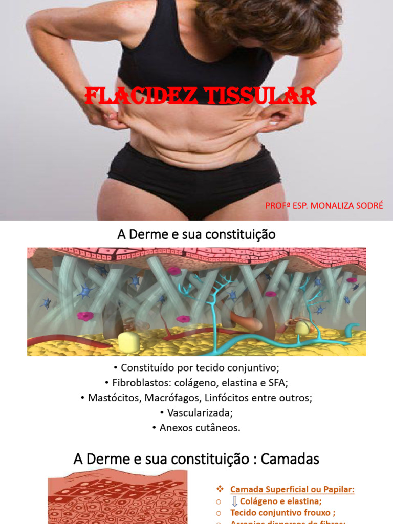 Flacidez Tissular e Muscular: Fisiologia e Causas | PDF | Colágeno ...