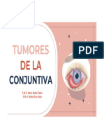 Exposición Tumores de La Conjuntiva
