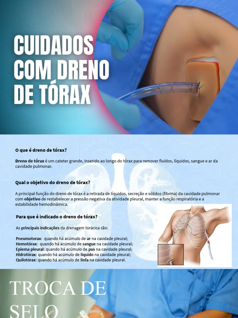 Dreno de Tórax: Indicações e Cuidados | PDF
