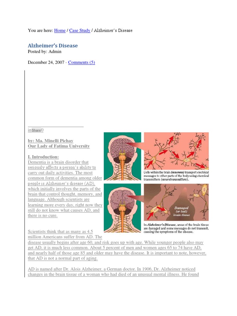 Alzheimers Case Study PDF Alzheimer's Disease Dementia