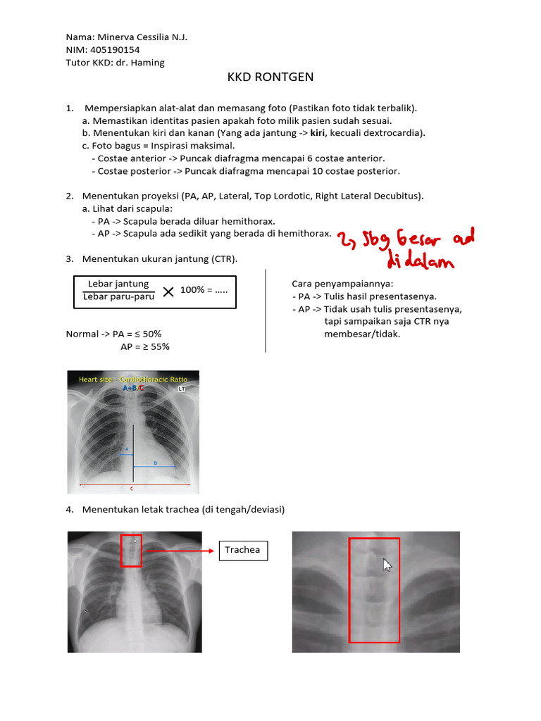 Evaluasi Rontgen Thorax dan Diafragma | PDF