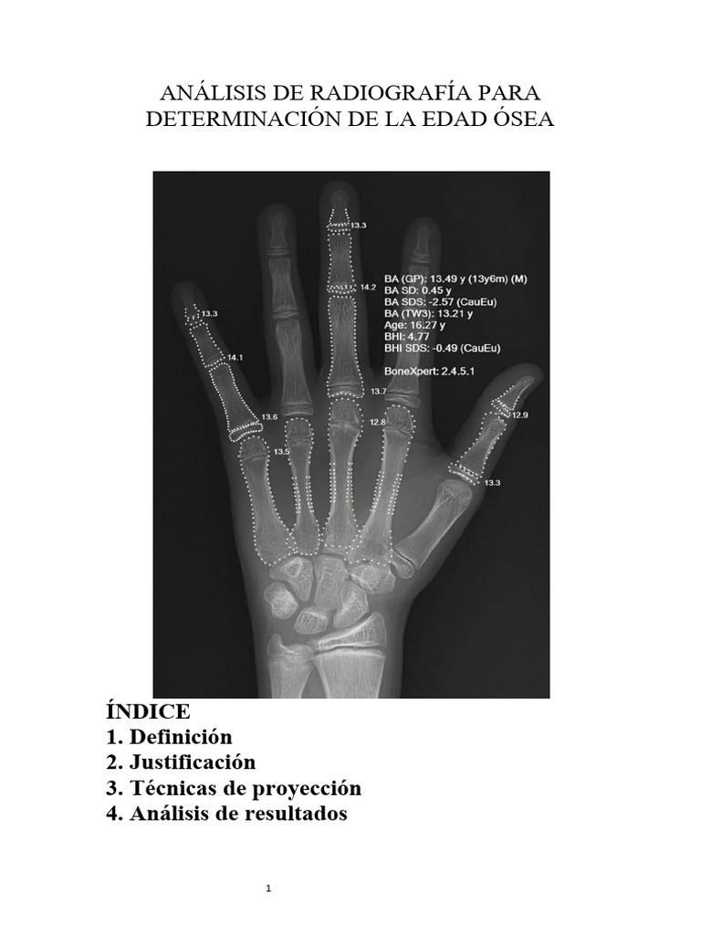 Análisis de Radiografía para Edad Ósea | PDF | Medicina | Enfermedades ...