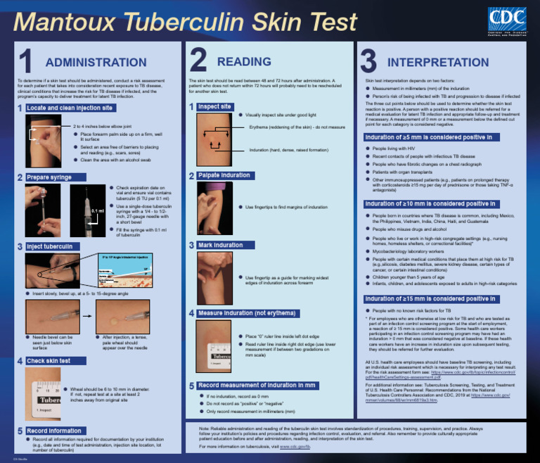 Mantoux test visual data 3