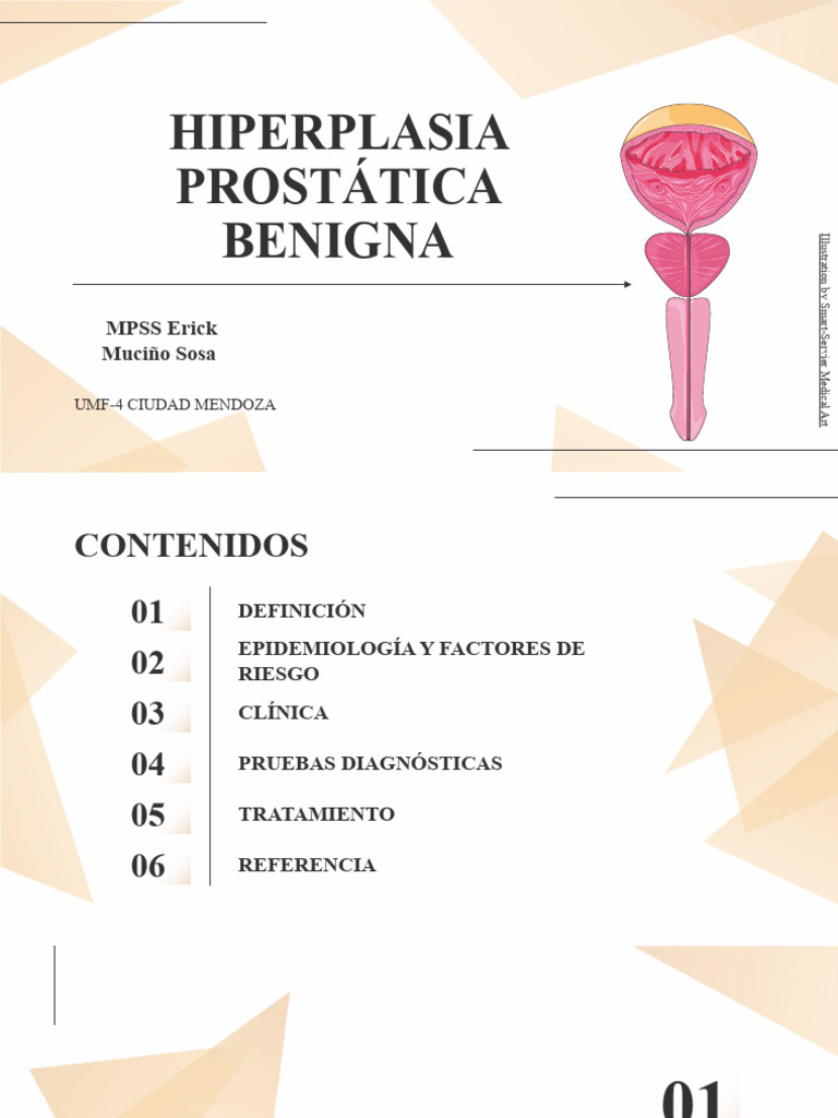Hiperplasia Prostática Benigna: Guía Completa | PDF | Especialidades ...