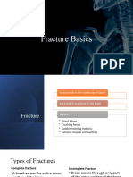 Fracture Basics