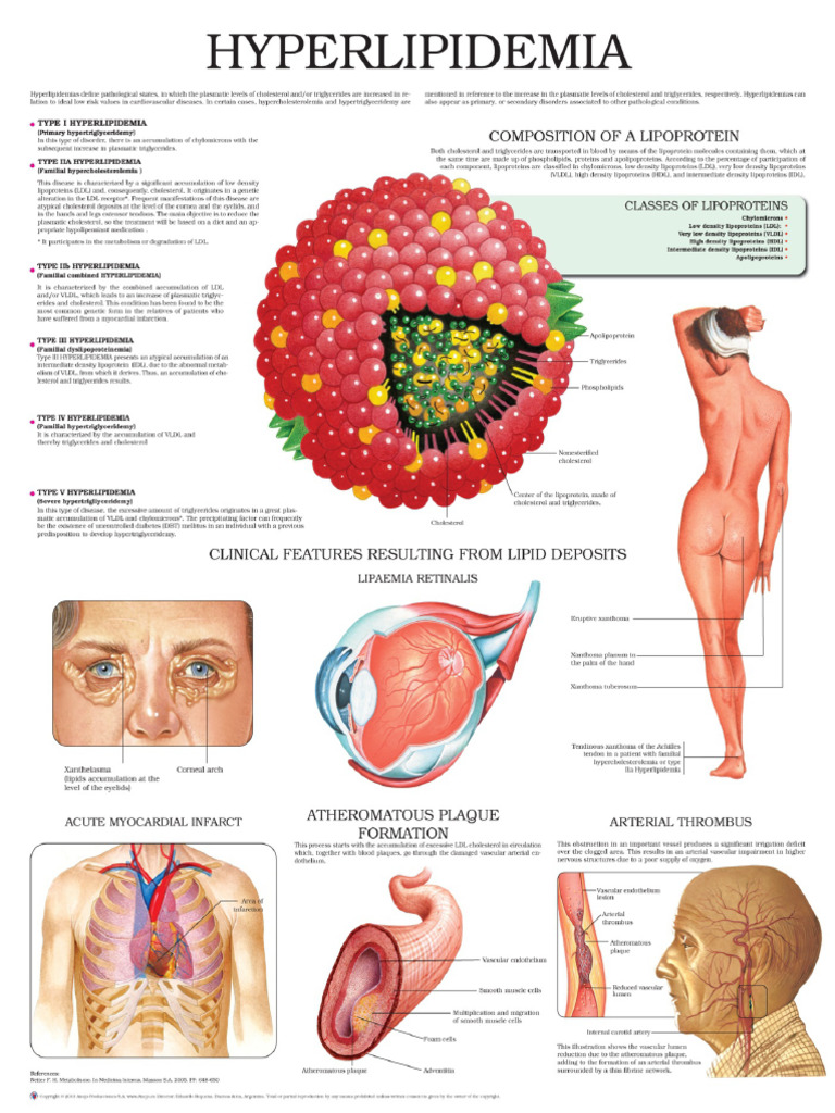 Hyperlipidemia e Chart - Full Illustrated | PDF | Influenza | Influenza ...