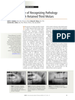 The Importance of recognizing pathology associated with retained third molars