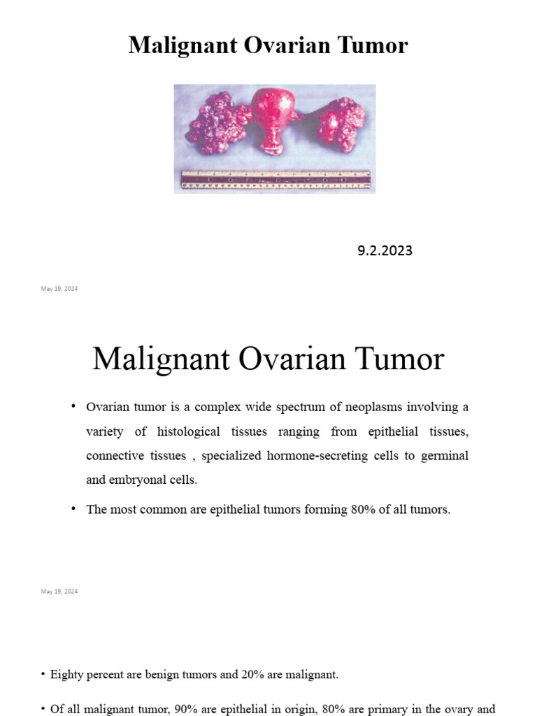 Malignant Ovarian Tumor Presetation | PDF | Ovarian Cancer | Chemotherapy