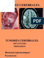 Clase 3 Tumores Cerebra Les