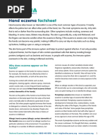 Understanding Dyshidrotic Eczema | PDF | Dermatitis | Topical Medication
