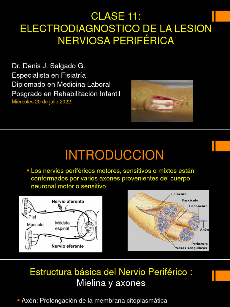 Electrodiagnóstico de Lesiones Nerviosas | PDF | Nervio | Electromiografia
