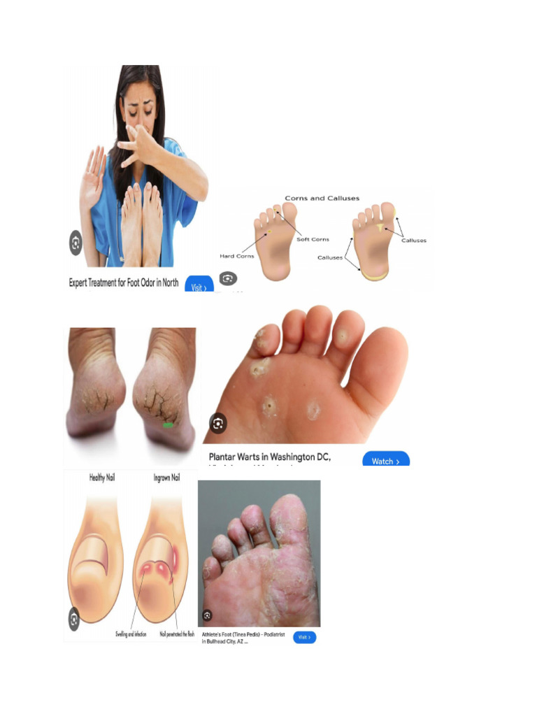 Foot | PDF