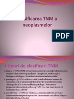 Clasificarea TNM A Neoplasmelor