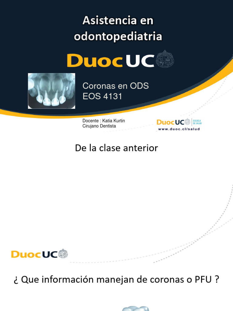 Coronas Metálicas y de Celuloide en ODS | PDF | Compuesto Dental | Diente