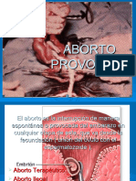 ABORTO