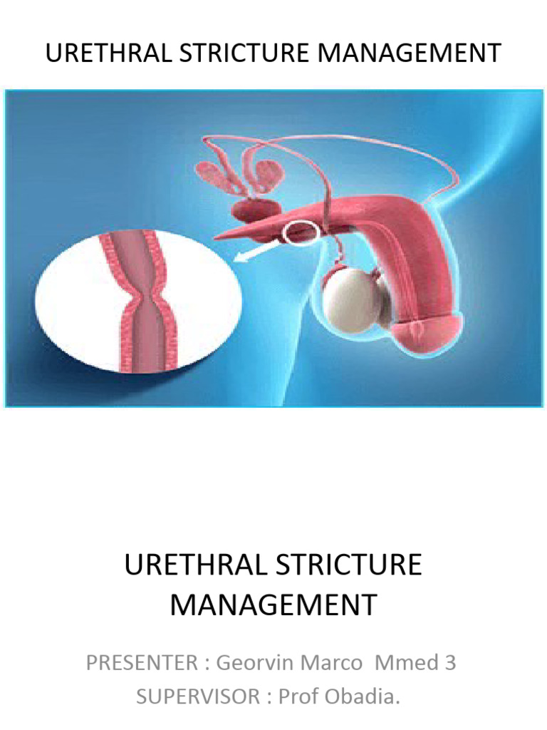 Urethral Stricture Management Overview | PDF | Urinary Tract Infection ...