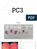 Muestra Histológica para Patologia PC3
