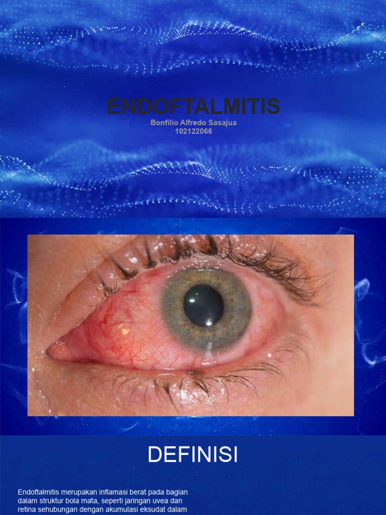 Panduan Endoftalmitis untuk Dokter | PDF