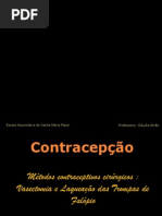 Métodos contraceptivos cirúrgicos