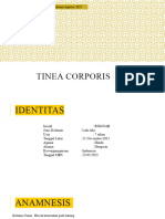 Tinea