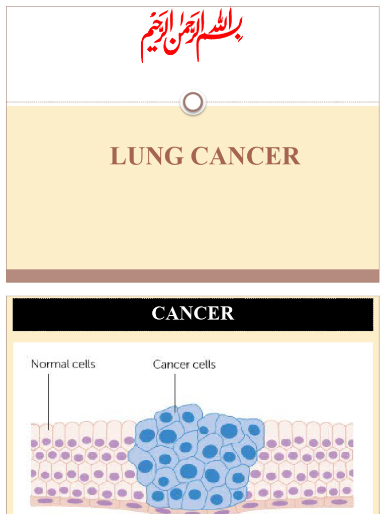 Lung Cancer | PDF | Cancer | Lung Cancer