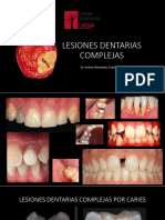 Clase 1 Lesiones Dentarias Complejas