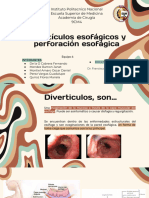 Divertículos Esofagicos y Perforacion Esofágica