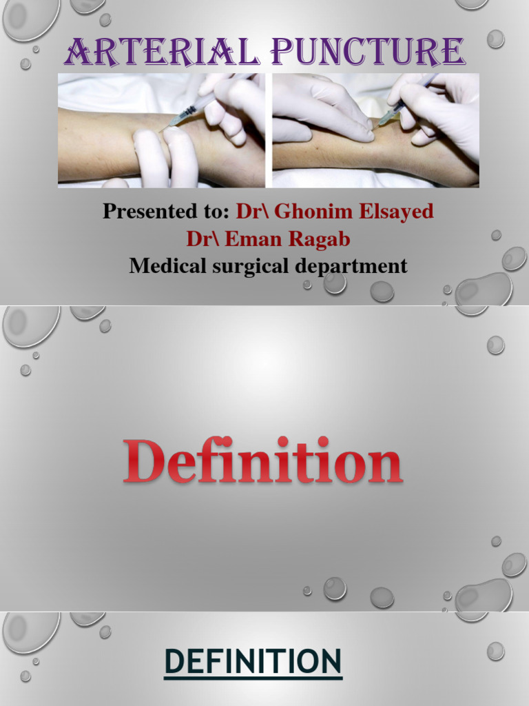 arterial puncture | Download Free PDF | Hand | Medicine