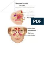 Nosología - Sinusitis