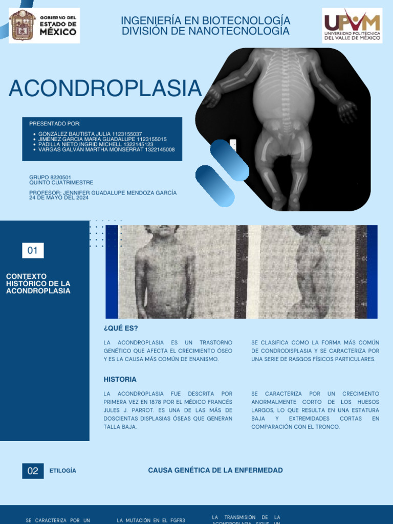 Acondroplasia: Diagnóstico y Tratamiento | PDF | Terapia | Enfermedades ...