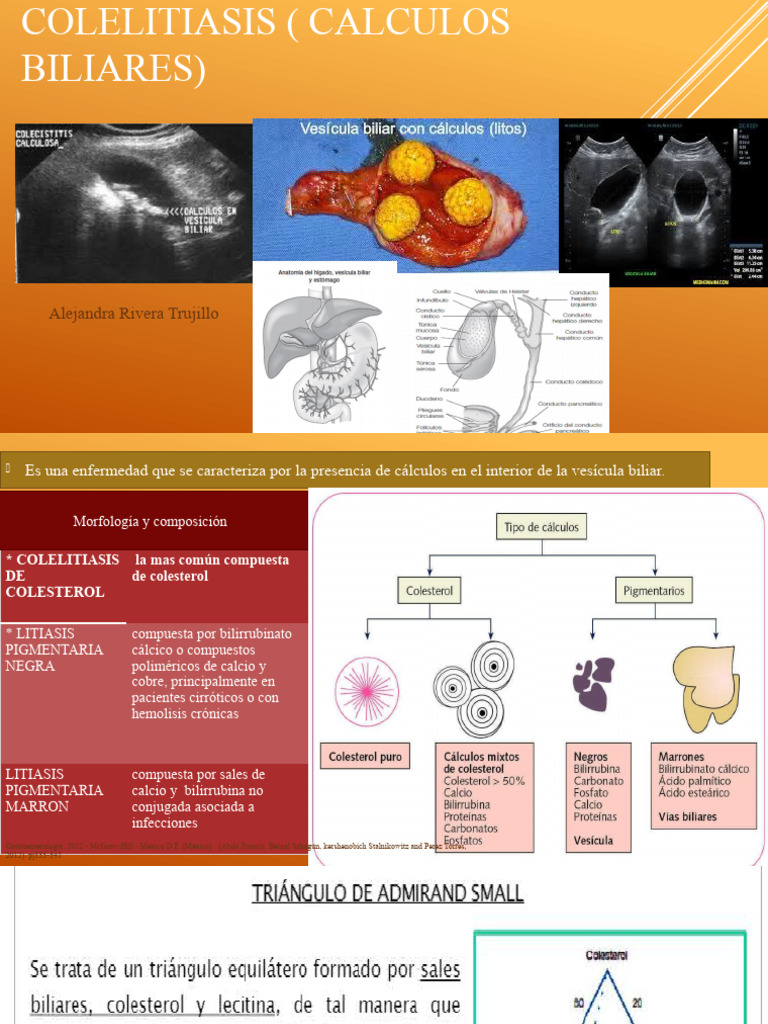 COLELITIASIS pptx | PDF | Gastroenterología | Enfermedades y trastornos