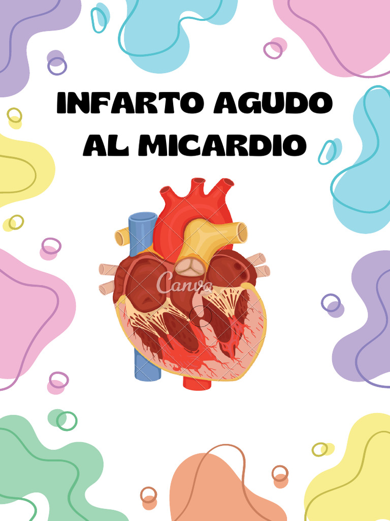 Infarto Agudo de Miocardio: Causas y Tratamiento | PDF | Infarto de ...