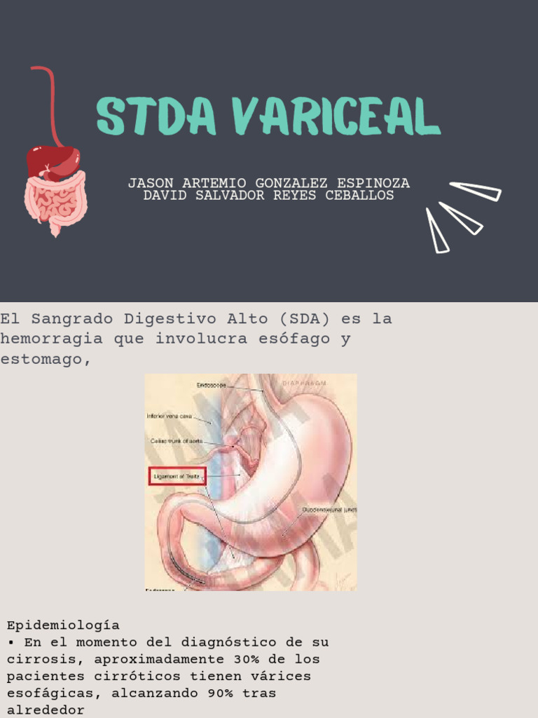 STDA Variceal | PDF