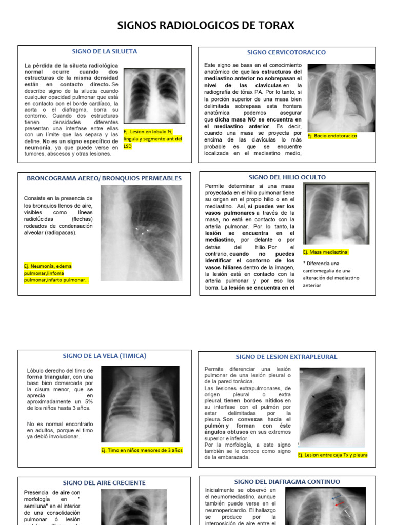 Signos Radiológicos en Tórax | PDF | Pulmón | Medicina CLINICA