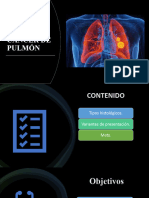 Cáncer de Pulmón.