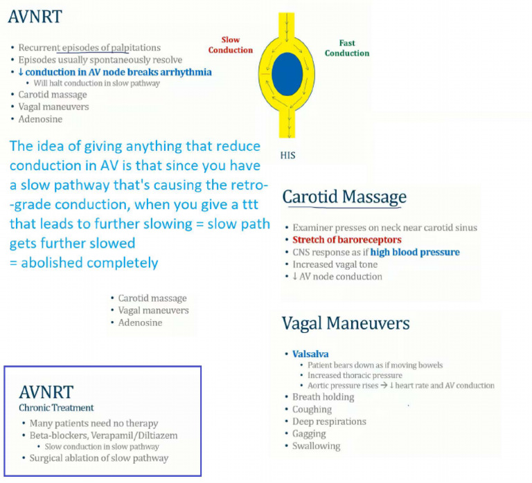 AVNRT | PDF