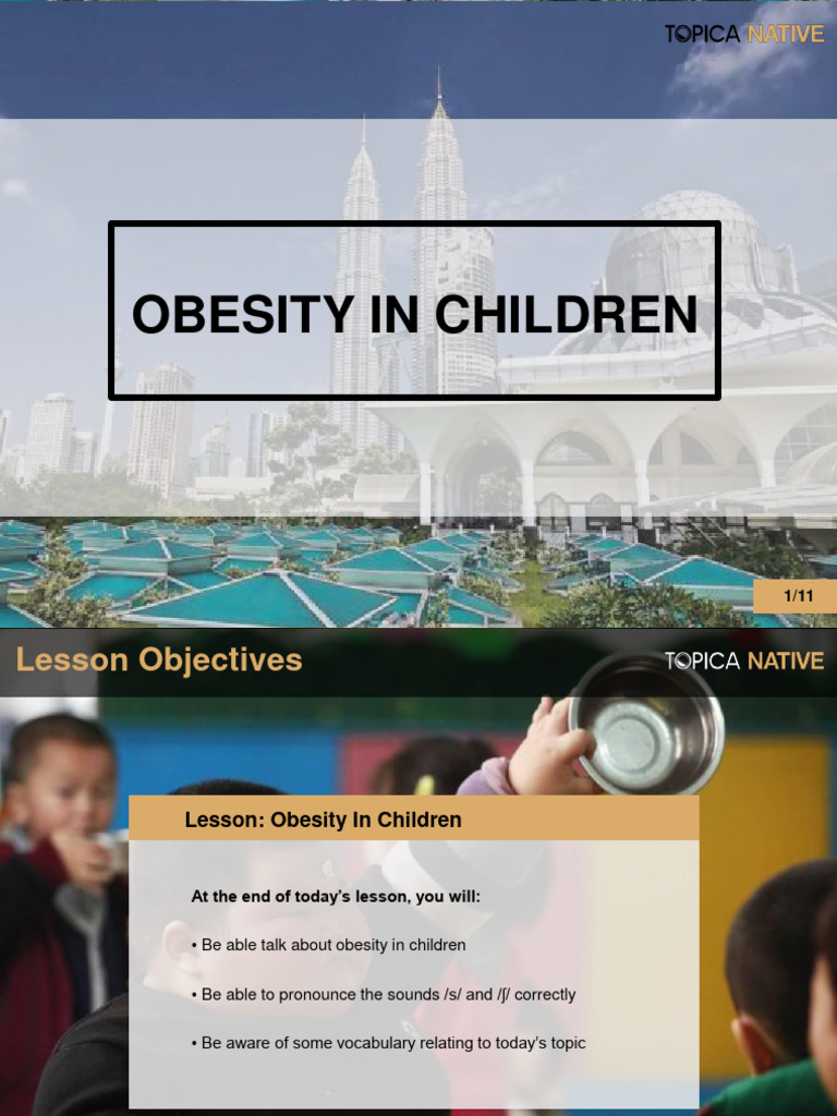 Understanding Childhood Obesity | PDF | Obesity