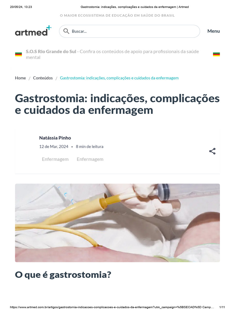 Cuidados e Complicações da Gastrostomia | PDF | Enfermagem | Medicina ...