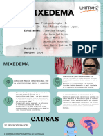Mixedema - Presentación (Fisp Ii)