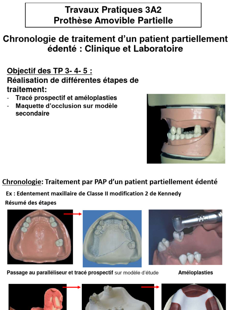 Traitement Prothétique PAP: Étapes Clés | PDF | Anatomie dentaire | Bouche