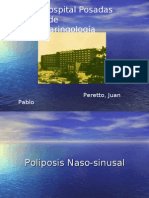 Poliposis Nasal