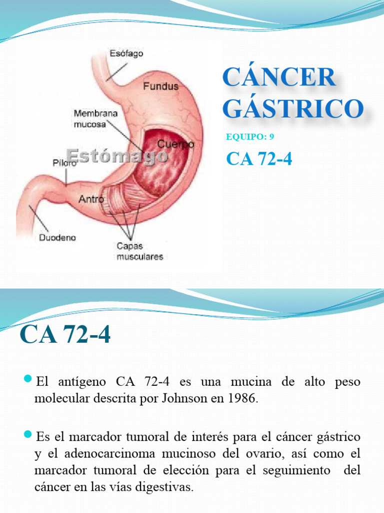 Cáncer Gástrico Marcador 72 4 Descargar Gratis Pdf Cáncer Cáncer