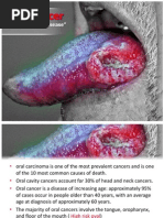 Oral Cancer: "The Forgotten Disease"