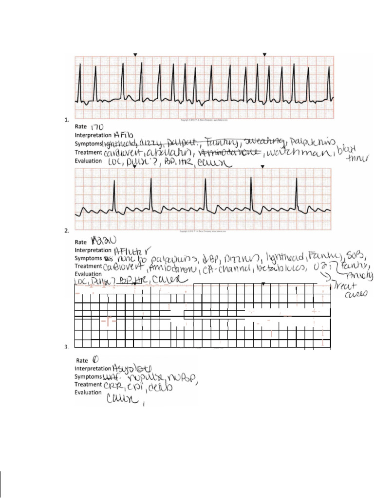 Ekg Turn | PDF