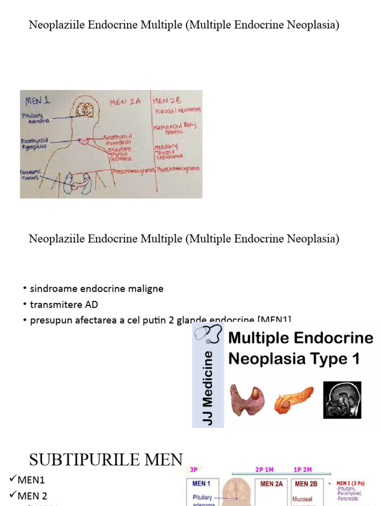 Multiple Endocrine Neoplasia Overview | PDF